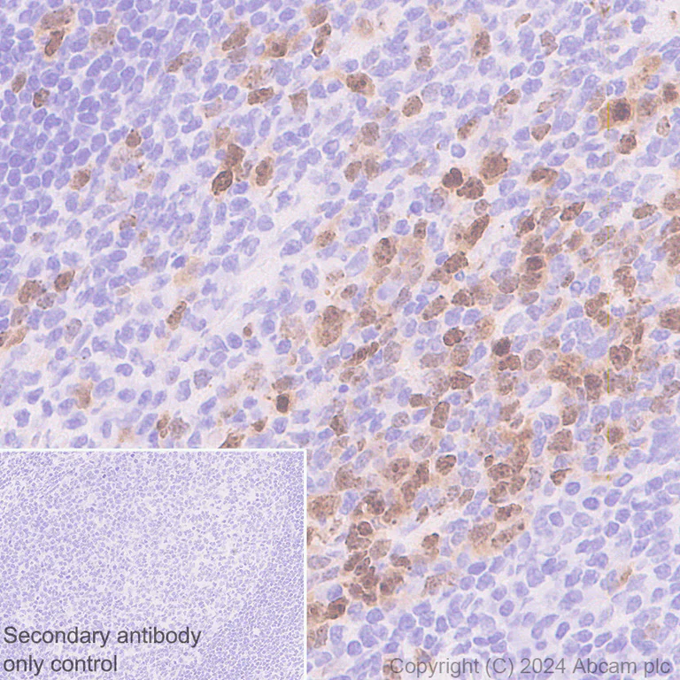 Immunohistochemistry (Formalin/PFA-fixed paraffin-embedded sections) - Anti-Aurora B antibody [RM1185] (AB317584)