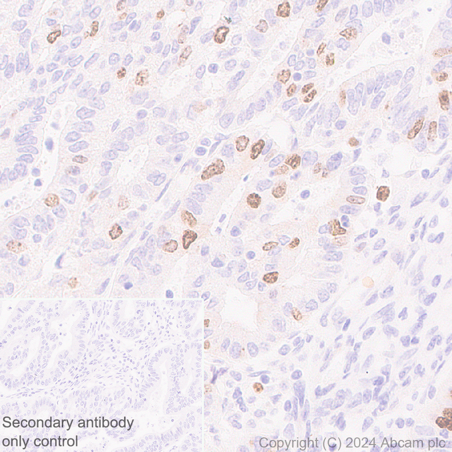 Immunohistochemistry (Formalin/PFA-fixed paraffin-embedded sections) - Anti-Aurora B antibody [RM1185] (AB317584)
