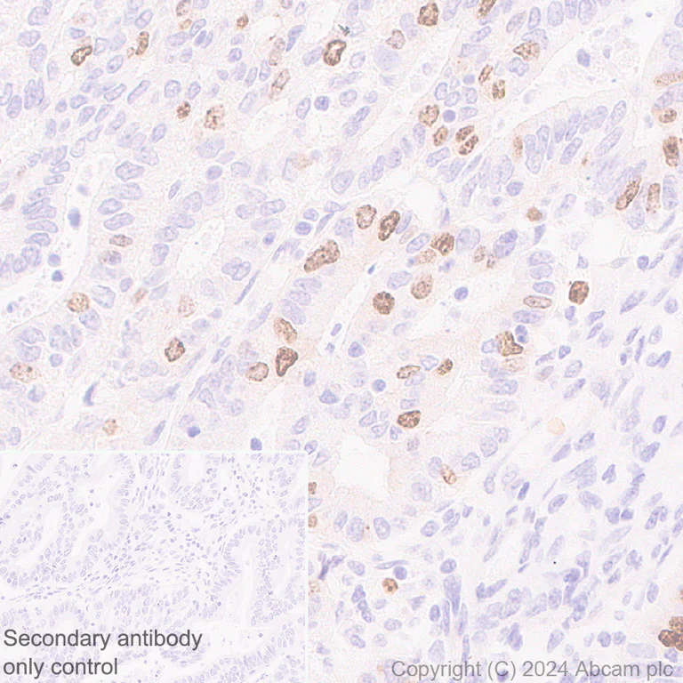 Immunohistochemistry (Formalin/PFA-fixed paraffin-embedded sections) - Anti-Aurora B antibody [RM1185] (AB317584)