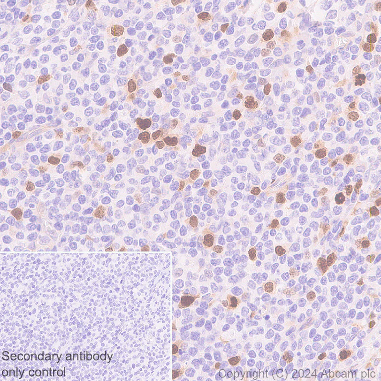 Immunohistochemistry (Formalin/PFA-fixed paraffin-embedded sections) - Anti-Aurora B antibody [RM1185] (AB317584)