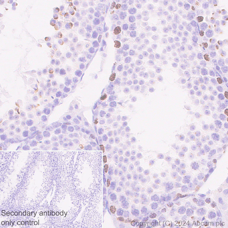 Immunohistochemistry (Formalin/PFA-fixed paraffin-embedded sections) - Anti-Aurora B antibody [RM1185] (AB317584)