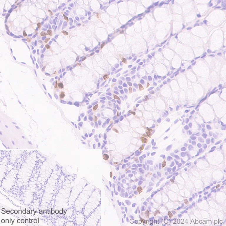 Immunohistochemistry (Formalin/PFA-fixed paraffin-embedded sections) - Anti-Aurora B antibody [RM1185] (AB317584)