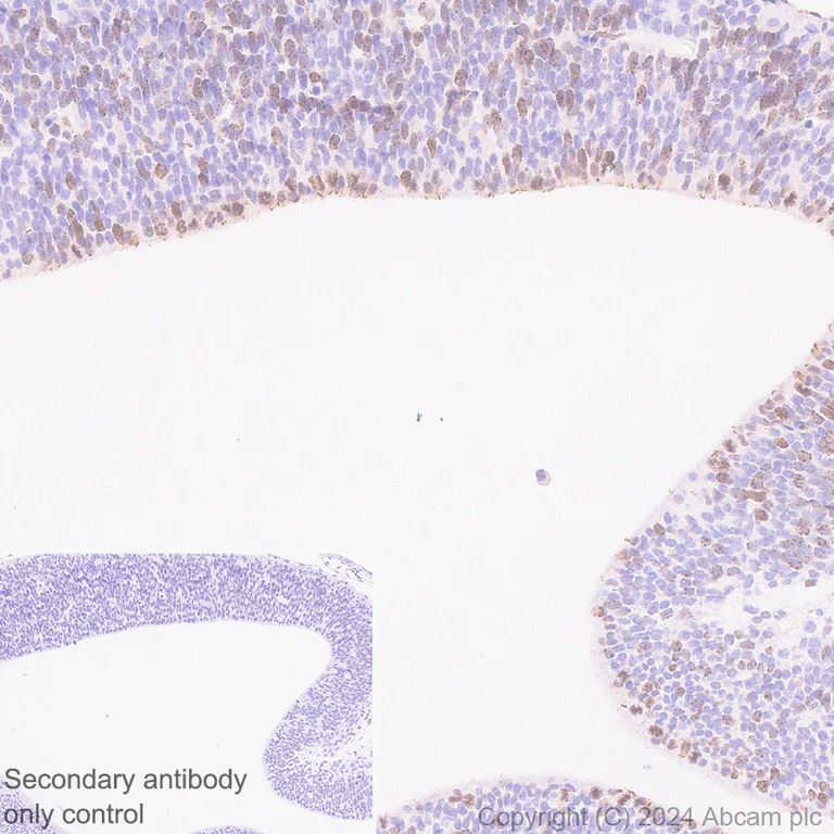 Immunohistochemistry (Formalin/PFA-fixed paraffin-embedded sections) - Anti-Aurora B antibody [RM1185] (AB317584)