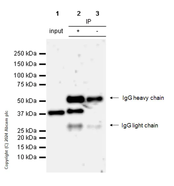 Immunoprecipitation - Anti-Aurora B antibody [RM1185] (AB317584)