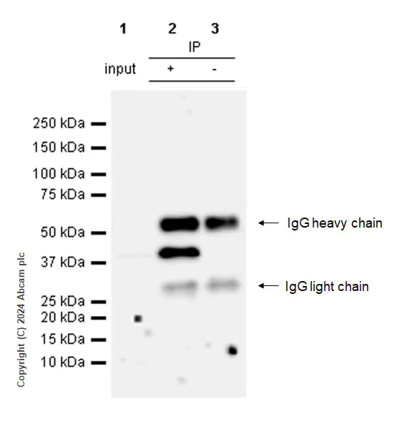 Immunoprecipitation - Anti-Aurora B antibody [RM1185] (AB317584)