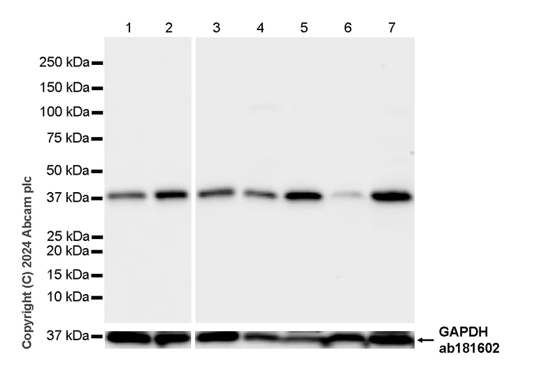 Western blot - Anti-Aurora B antibody [RM1185] (AB317584)