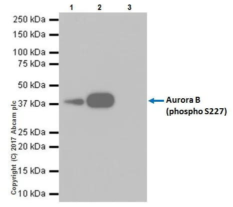 Immunoprecipitation - Anti-Aurora B (phospho S227) antibody [EPR20389] (AB210706)