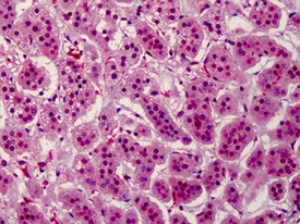 Immunohistochemistry (Formalin/PFA-fixed paraffin-embedded sections) - Anti-Aurora B (phospho T232) antibody (AB115793), expandable thumbnail