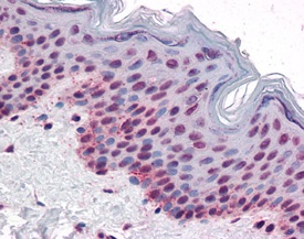 Immunohistochemistry (Formalin/PFA-fixed paraffin-embedded sections) - Anti-Aurora B (phospho T232) antibody (AB115793), expandable thumbnail