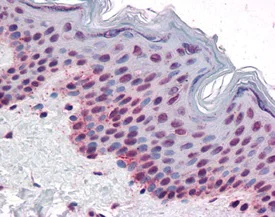 Immunohistochemistry (Formalin/PFA-fixed paraffin-embedded sections) - Anti-Aurora B (phospho T232) antibody (AB115793)