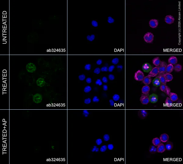 Immunocytochemistry/ Immunofluorescence - Anti-Aurora kinase A (phospho T288) antibody [EPR28759-80] (AB324635)