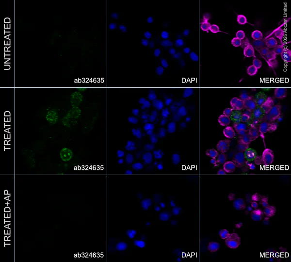 Immunocytochemistry/ Immunofluorescence - Anti-Aurora kinase A (phospho T288) antibody [EPR28759-80] (AB324635)