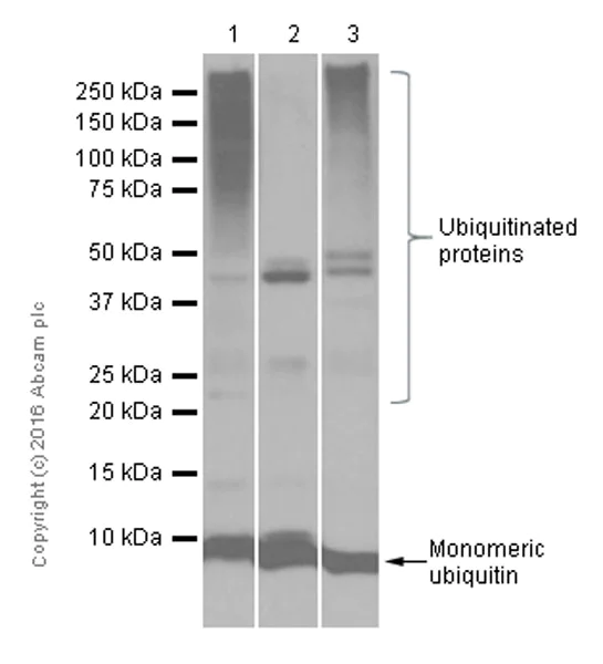 Western blot - Autophagy Analysis (ATG16L1, ATG16L1 pS278, SQSTM1, LC3B, Ubiquitin, M6PR) Antibody Sampler Panel (AB269811)