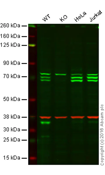 Western blot - Autophagy Analysis (ATG16L1, ATG16L1 pS278, SQSTM1, LC3B, Ubiquitin, M6PR) Antibody Sampler Panel (AB269811)