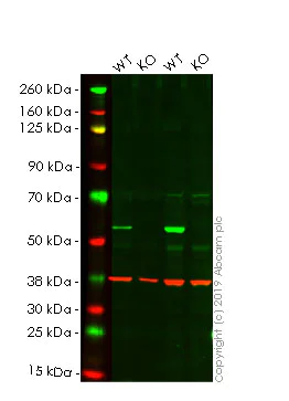 Western blot - Autophagy Analysis (ATG16L1, ATG16L1 pS278, SQSTM1, LC3B, Ubiquitin, M6PR) Antibody Sampler Panel (AB269811)