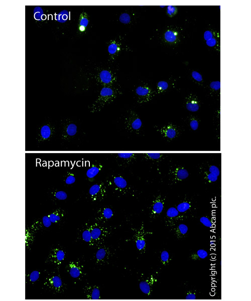 Autophagy Assay Kit (ab139484) Abcam
