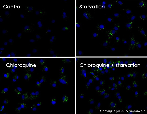 Functional Studies - Autophagy Assay Kit (AB139484)