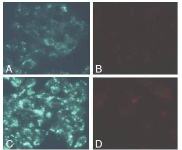 Functional Studies - Autophagy/Cytotoxicity Dual Staining Kit (AB133075)