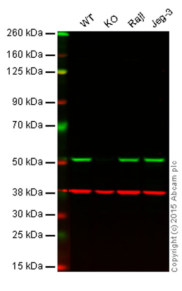 Western blot - Autophagy Marker (APG5L/ATG5, ATG16L1, ATG4B, ATG9A, Beclin 1, LC3B) Antibody Sampler Panel (AB228525), expandable thumbnail