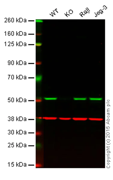 Western blot - Autophagy Marker (APG5L/ATG5, ATG16L1, ATG4B, ATG9A, Beclin 1, LC3B) Antibody Sampler Panel (AB228525)