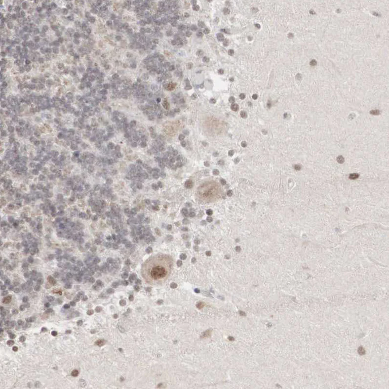 Immunohistochemistry (Formalin/PFA-fixed paraffin-embedded sections) - Anti-AUTS2 antibody (AB224035)
