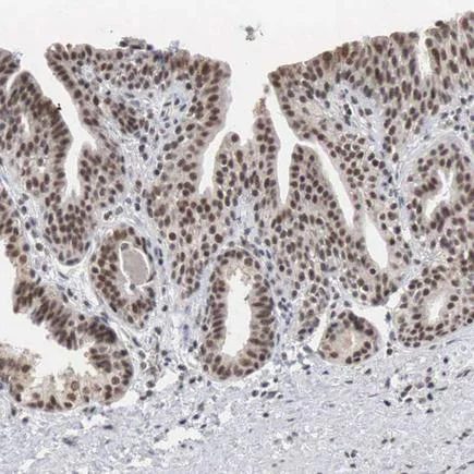 Immunohistochemistry (Formalin/PFA-fixed paraffin-embedded sections) - Anti-AUTS2 antibody (AB224035)