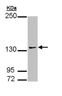 Western blot - Anti-AUTS2 antibody (AB96326)