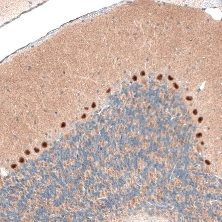Immunohistochemistry (Formalin/PFA-fixed paraffin-embedded sections) - Anti-AUTS2 antibody [CL7067] (AB243042)