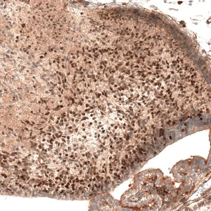 Immunohistochemistry (Formalin/PFA-fixed paraffin-embedded sections) - Anti-AUTS2 antibody [CL7067] (AB243042)