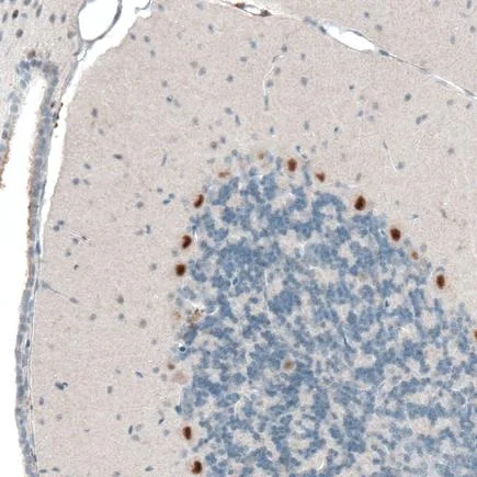 Immunohistochemistry (Formalin/PFA-fixed paraffin-embedded sections) - Anti-AUTS2 antibody [CL7084] (AB243036)