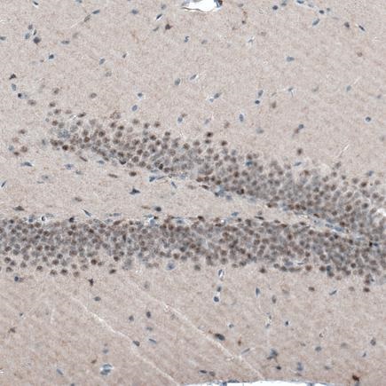 Immunohistochemistry (Formalin/PFA-fixed paraffin-embedded sections) - Anti-AUTS2 antibody [CL7084] (AB243036), expandable thumbnail