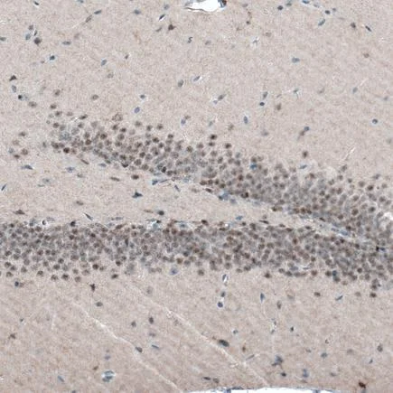 Immunohistochemistry (Formalin/PFA-fixed paraffin-embedded sections) - Anti-AUTS2 antibody [CL7084] (AB243036)