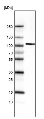 Western blot - Anti-AUTS2 antibody [CL7084] (AB243036), expandable thumbnail