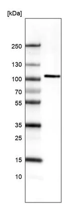 Western blot - Anti-AUTS2 antibody [CL7084] (AB243036)