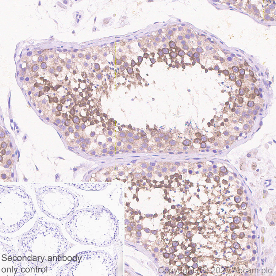 Immunohistochemistry (Formalin/PFA-fixed paraffin-embedded sections) - Anti-AVEN antibody [EPR4720] (AB133285)