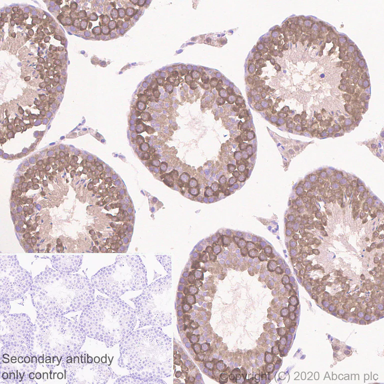 Immunohistochemistry (Formalin/PFA-fixed paraffin-embedded sections) - Anti-AVEN antibody [EPR4720] - BSA and Azide free (AB248447)