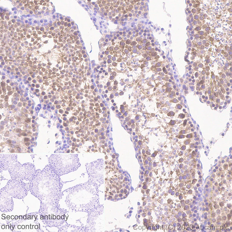 Immunohistochemistry (Formalin/PFA-fixed paraffin-embedded sections) - Anti-AVEN antibody [EPR4720] - BSA and Azide free (AB248447)
