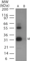 Western blot - Anti-Avian Influenza Matrix Protein I antibody (AB25918)