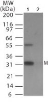 Western blot - Anti-Avian Influenza Matrix Protein I antibody (AB25919)