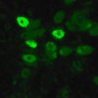 Immunocytochemistry/ Immunofluorescence - Anti-Avian Influenza Nucleoprotein antibody (AB22285), expandable thumbnail