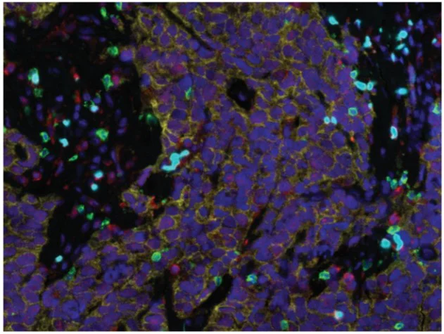 Immunohistochemistry (Formalin/PFA-fixed paraffin-embedded sections) - Avidin/Biotin Blocking Kit (AB64212)