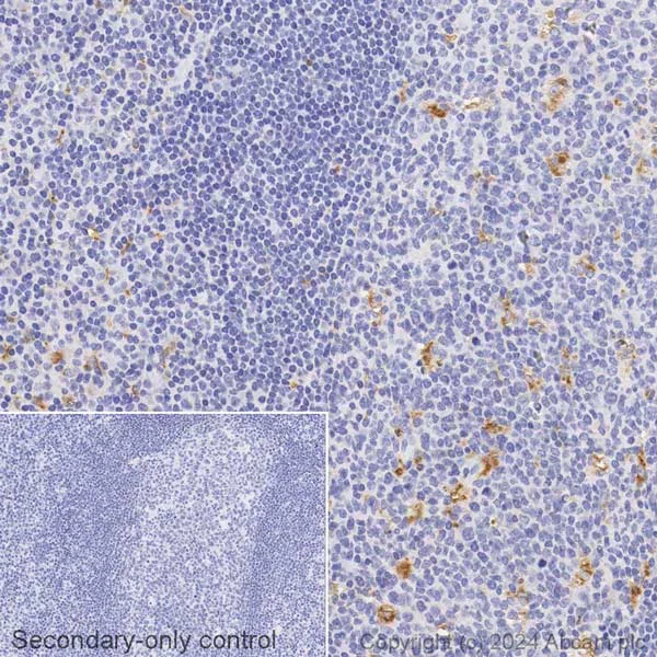Immunohistochemistry (Formalin/PFA-fixed paraffin-embedded sections) - Avidin/Biotin Blocking Kit (AB64212)