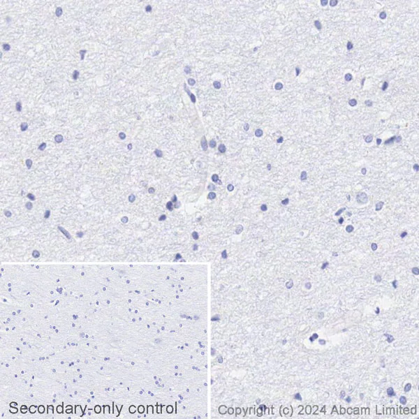 Immunohistochemistry (Formalin/PFA-fixed paraffin-embedded sections) - Avidin/Biotin Blocking Kit (AB64212)