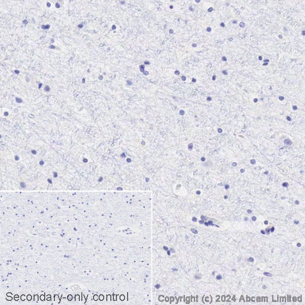 Immunohistochemistry (Formalin/PFA-fixed paraffin-embedded sections) - Avidin/Biotin Blocking Kit (ab64212), expandable thumbnail