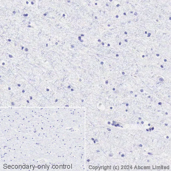Immunohistochemistry (Formalin/PFA-fixed paraffin-embedded sections) - Avidin/Biotin Blocking Kit (AB64212)