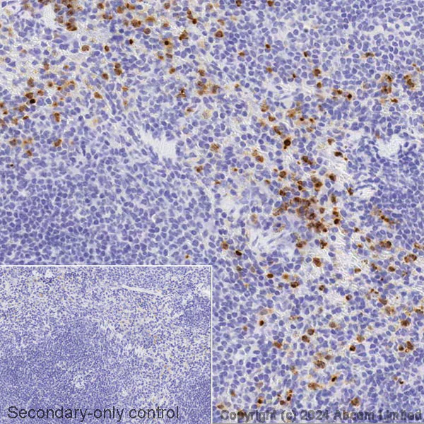 Immunohistochemistry (Formalin/PFA-fixed paraffin-embedded sections) - Avidin/Biotin Blocking Kit (AB64212)