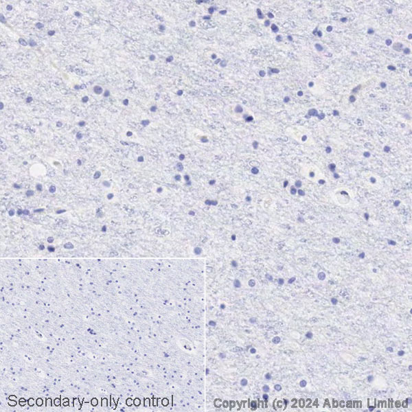 Immunohistochemistry (Formalin/PFA-fixed paraffin-embedded sections) - Avidin/Biotin Blocking Kit (ab64212), expandable thumbnail