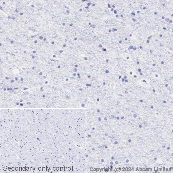 Immunohistochemistry (Formalin/PFA-fixed paraffin-embedded sections) - Avidin/Biotin Blocking Kit (AB64212)