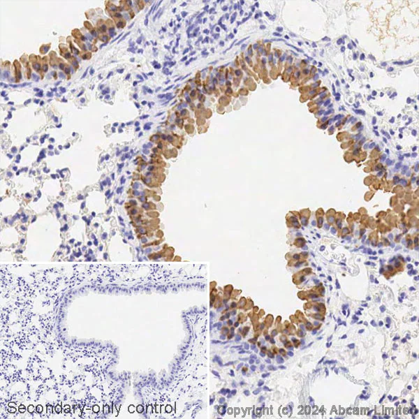 Immunohistochemistry (Formalin/PFA-fixed paraffin-embedded sections) - Avidin/Biotin Blocking Kit (AB64212)