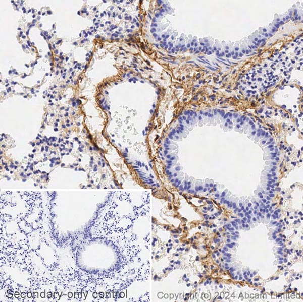 Immunohistochemistry (Formalin/PFA-fixed paraffin-embedded sections) - Avidin/Biotin Blocking Kit (ab64212), expandable thumbnail